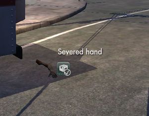 Severed hand.jpg